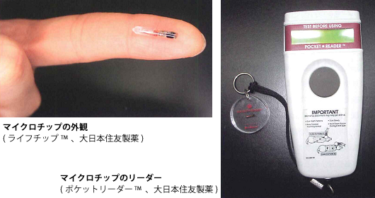 ����ǂ������a�@ �}�C�N���`�b�v�ƃ��[�_�[